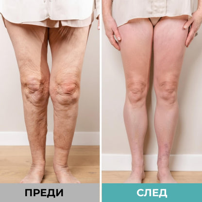 Електрически масажор за крака