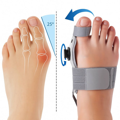 Ортеза за изпъкнало кокалче